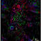 scratchboard-insanity by enadiate