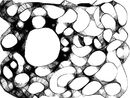 spiders-eggs